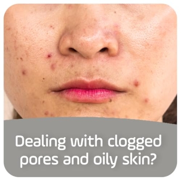 Asepxia Acne Treatment Soap for Oily Skin