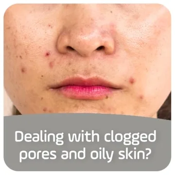 Asepxia Acne Treatment Soap for Oily Skin