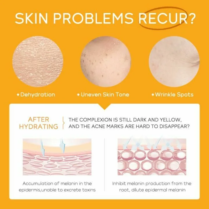 Teen Skincare Gift Set | 5Pcs Vitamin C Collection