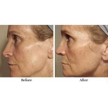 City Beauty Barrier Rescue Firming Night Cream - Plump & Smooth - Overnight Moisturizer with Peptide...