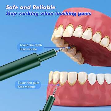 Plaque Remover for Teeth, Ultrasonic Vibration 3 Million Times/Min, Deep Cleaning, Intelligent Safety Mode, Relieve Sensitive Teeth Discomfort, for Removing Plaque, Tartar, Stains, Dental Calculus