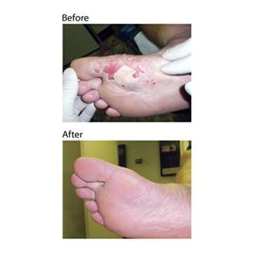 Dr. Nordyke's Wound Honey New Zealand Manuka Honey for Infections,Burns,Cuts and Scars (80g)