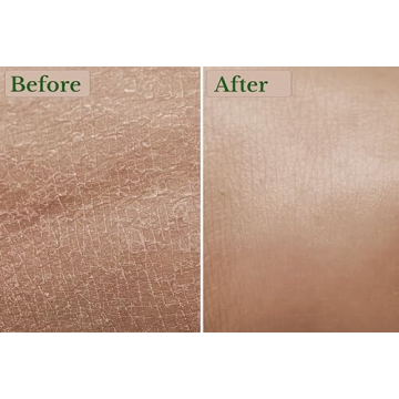 Organic Colloidal Oatmeal Powder for Baths and Skin Care