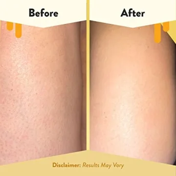 Eczema Honey Soothing Body Wash for Sensitive Skin