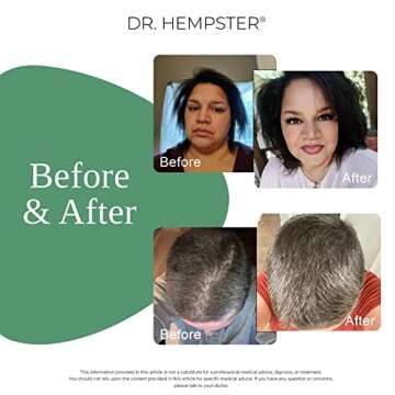 Biotin Hair Loss & Thinning Treatment for Men & Women - Hair Growth Shampoo for Regrowth