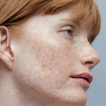 Obagi Nu-Derm Toner - Alcohol-Free Skin Balancer 6.7 oz