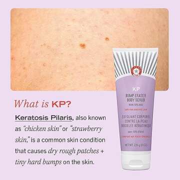 First Aid Beauty - KP Bump Eraser Body Scrub with 10% AHA, Keratosis Pilaris Skin Exfoliater with Glycolic and Lactic acids, Helps Reduce Chicken Skin Bumps, Safe for Sensitive Skin, 4 oz