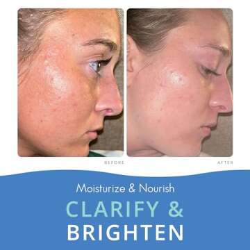 Almond Clear 2-in-1 Hydrating Gel | Lightweight Mandelic Acid Moisturizer for Oily, Blemish-Prone Skin | Aloe Vera, Squalane, Hyaluronic Acid, Mandelic Acid, Bakuchiol | 4 oz