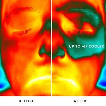 Clarisonic Smart Sonic Awakening Eye Massager