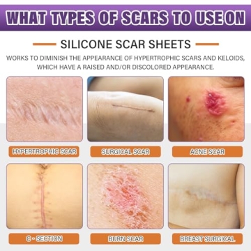 Silicone Scar Sheets - Effective Scar Treatment & Healing Tape