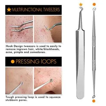 7-Piece Blackhead Remover Kit - Pimple Comedone Extractor Tool set for Facial Acne and Treatment for Blemish, Whitehead Popping, Zit Removing for Risk Free Nose Face Skin with Metal Case