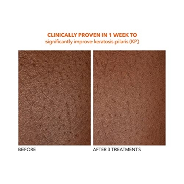 Achieve Smooth Skin with Dr Dennis Gross Body Treatment