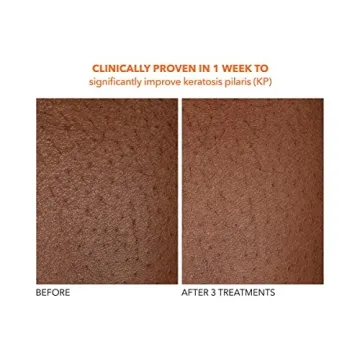 Achieve Smooth Skin with Dr Dennis Gross Body Treatment