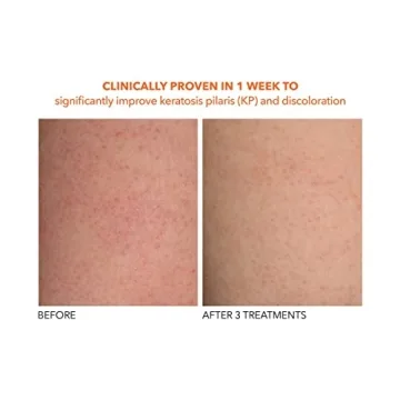 Achieve Smooth Skin with Dr Dennis Gross Body Treatment