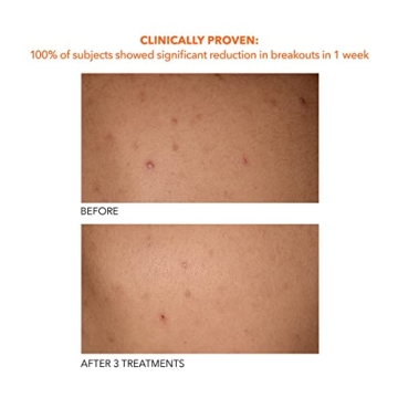 Achieve Smooth Skin with Dr Dennis Gross Body Treatment