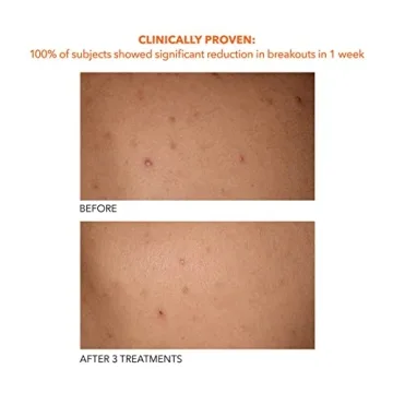 Achieve Smooth Skin with Dr Dennis Gross Body Treatment