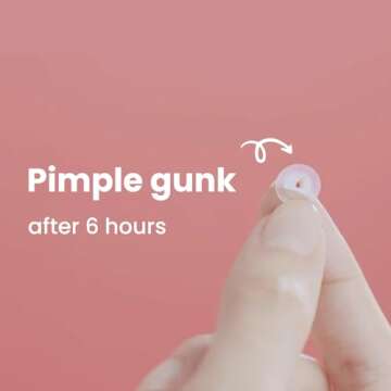 ROSELYNBOUTIQUE Hydrocolloid Pimple Patches - Fast Healing