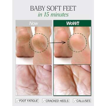 Moisturizing Foot Mask for Dry Cracked Feet | Spa Kit