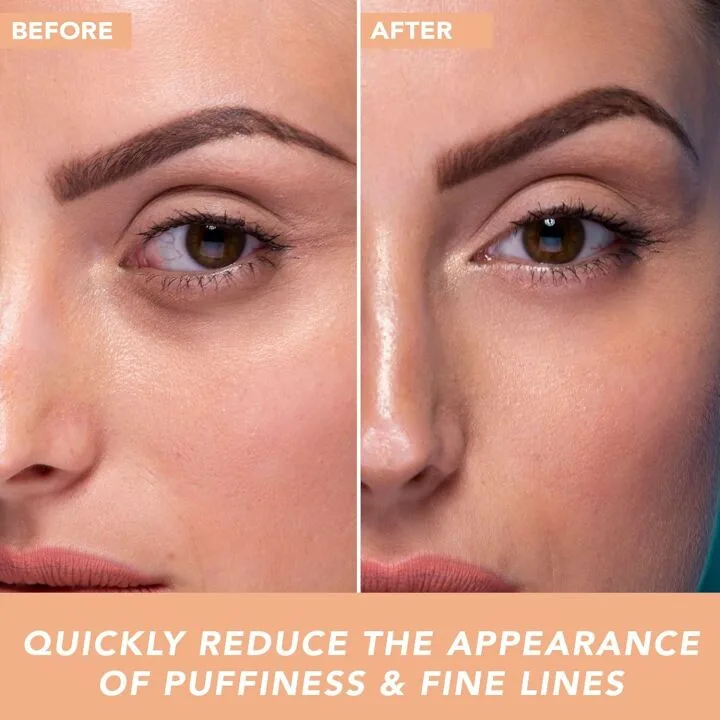 Natural Eye Gel for Dark Circles - USA Made