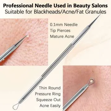 Blackhead Remover Tool Kit - 2 Stainless Steel Tools