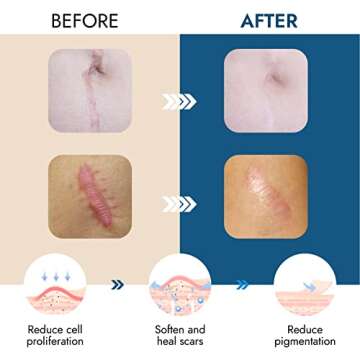 Scarbandit Silicone Scar Sheets - Superior Adhesion & Comfort for Healing Scars