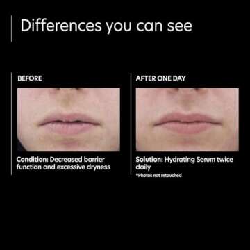 PCA SKIN Hydrating Serum for Sensitive Skin - 1 fl oz