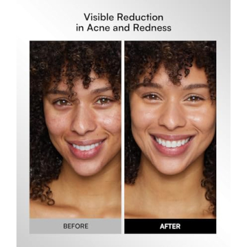 Wireless Red Light Therapy Mask for Home and Travel