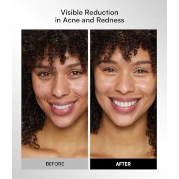 Wireless Red Light Therapy Mask for Home and Travel