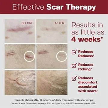 Physician Silicone Scar Sheets - Premium Quality Solution