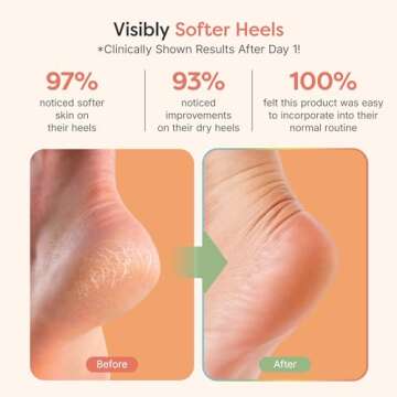 ZenToes Moisturizing Fuzzy Sleep Socks for Soft Heels