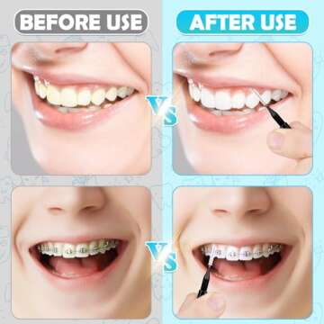 Superior Oral Care with MAPVOLUT 120 Interdental Brushes