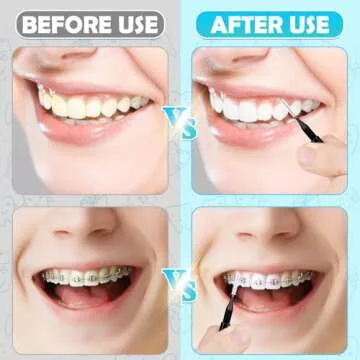 Superior Oral Care with MAPVOLUT 120 Interdental Brushes