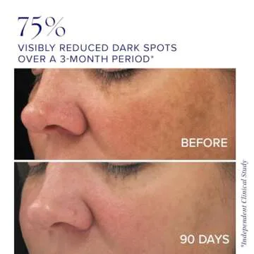 iS CLINICAL Brightening Complex, Skin Brightening Complex, Addresses Age Spots