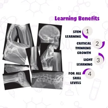 Roylco X-Rays – Realistic Fracture Images for Learning