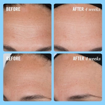 First Aid Beauty Firming Collagen Cream with Collagen, Peptides and Niacinamide – Day + Night Anti-Aging Face Moisturizer – 1.7 fl oz