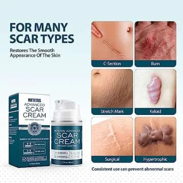 Metetas Advanced Scar Cream 1.7 Oz, Scar Cream Gel For Surgical, C-Section, Stretch Marks, Keloids, Burns Reducing Treatment, Silicone Scar Gel Effective Remove Old & New Scars -50ml