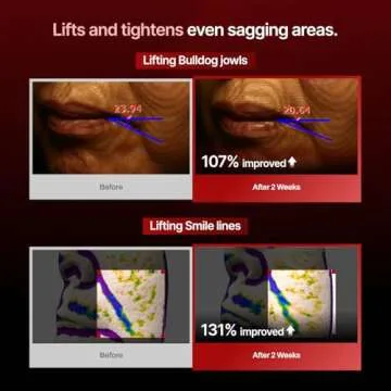 MEDITHERAPY Wrinkle-fit Mask + Facial Roller, Collagen Mask, Lifting Sagging Skin, Hydrating, Improving Elasticity, Glass Skin, Korean Skincare