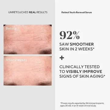 Murad Youth Renewal Retinol Anti-Aging Skin Care Kit