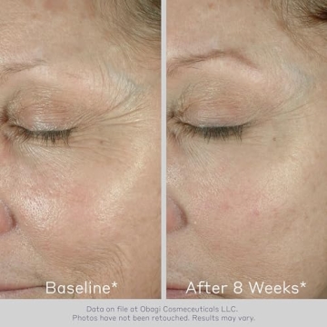 Obagi ELASTIderm Eye Cream Reduces Fine Lines Wrinkles