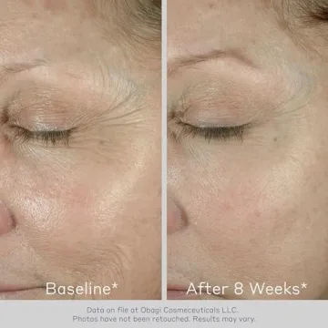 Obagi ELASTIderm Eye Cream Reduces Fine Lines Wrinkles