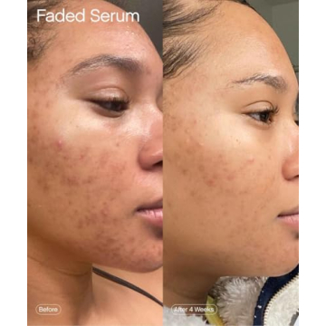 Topicals Faded Serum for Dark Spots & Scars Vegan Cruelty-Free