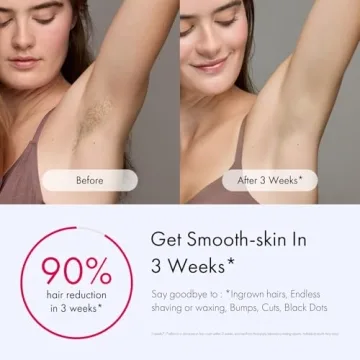 Ulike Air 3 IPL Hair Removal Device for Effortless Smooth Skin