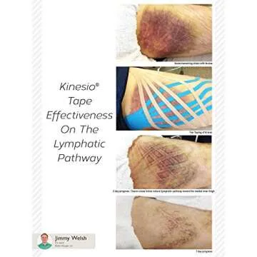 Kinesio Classic Edema Strips 12 Pack for Muscle Relief