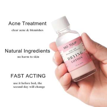 Acne Drying Lotion, Overnight Acne Acid and Acne Spot Treatment, Pimple Spot Treatment, Dry Out Pimples, Blemishes, and Zits (1OZ)