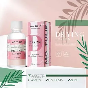 Acne Drying Lotion, Overnight Acne Acid and Acne Spot Treatment, Pimple Spot Treatment, Dry Out Pimples, Blemishes, and Zits (1OZ)