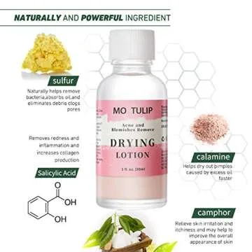 Acne Drying Lotion, Overnight Acne Acid and Acne Spot Treatment, Pimple Spot Treatment, Dry Out Pimples, Blemishes, and Zits (1OZ)