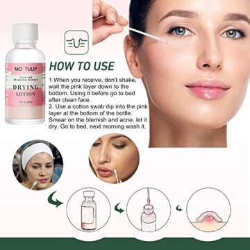 Acne Drying Lotion, Overnight Acne Acid and Acne Spot Treatment, Pimple Spot Treatment, Dry Out Pimples, Blemishes, and Zits (1OZ)