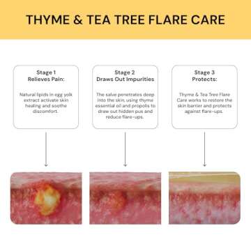 Thyme & Tea Tree Flare Care | Solution for Painful Pimples, Cystic Acne, Ingrowns, Folliculitis, Groin Flare Ups, Razor Bumps | Bartholin | Safe, All-Natural Flare-Up Solution with Egg Yolk Extract & Tea Tree 4 oz