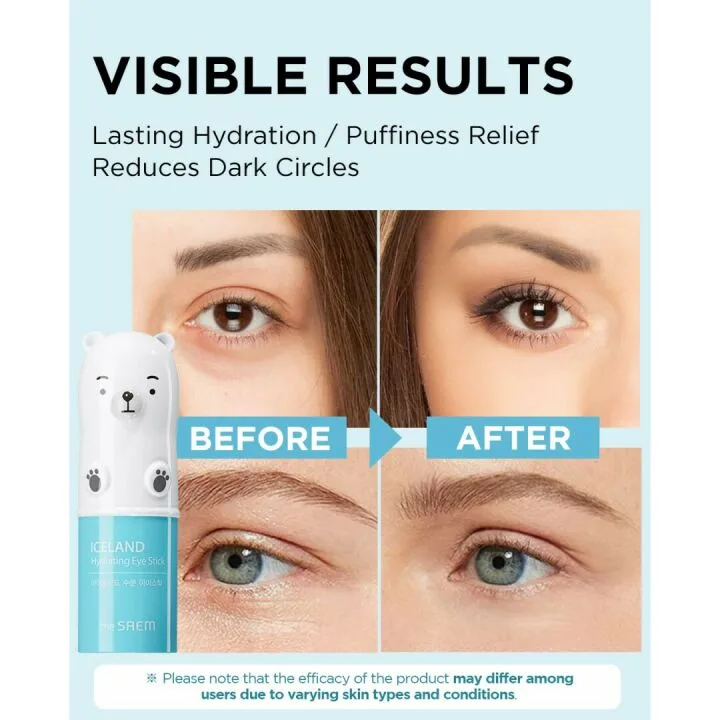 Cooling Eye Stick for Dark Circles - THESAEM