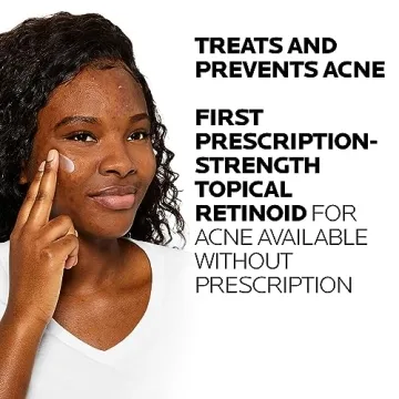 La Roche-Posay Adapalene Gel 0.1% for Acne Treatment
